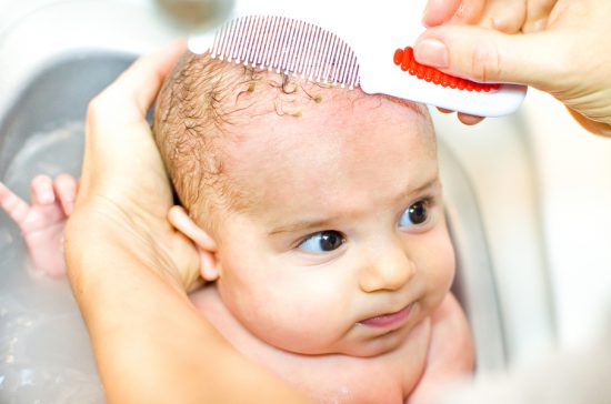 Baby being combed for cradle cap